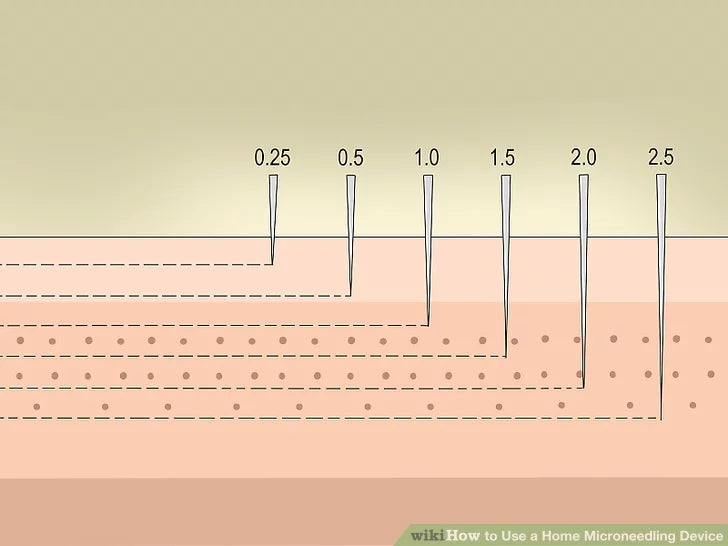 Bước 2: Xác định chiều dài của các kim.