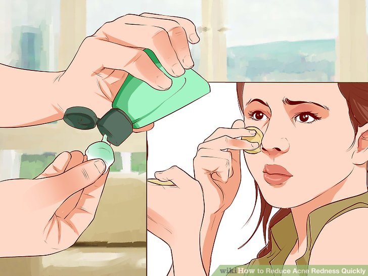 Bước 4: Dùng thuốc nhỏ mắt