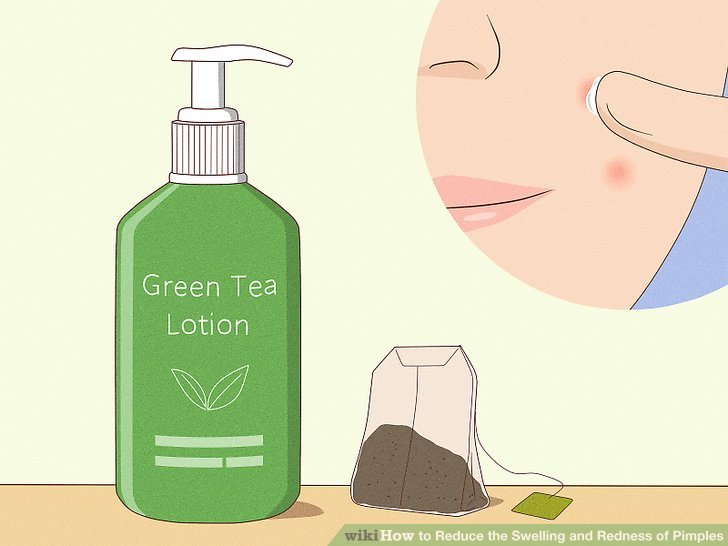 Hãy thử dùng lotion có chiết xuất trà xanh hoặc một túi trà đã qua sử dụng