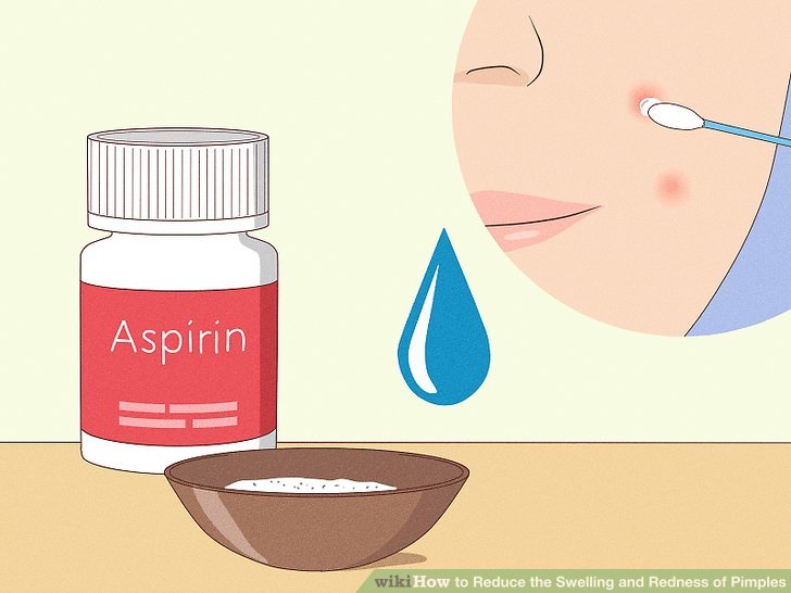 Hãy thử phương pháp truyền thống này nếu bạn có sẵn Aspirin
