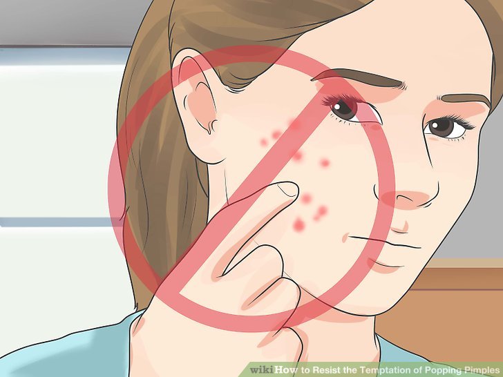 Bước 1: Ngăn ngừa tổn thương trên da bằng cách tránh nặn hay cạy mụn