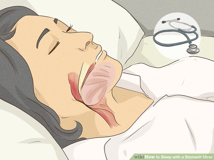 Điều trị chứng ngưng thở khi ngủ và các chứng rối loạn giấc ngủ khác với sự giúp đỡ của bác sĩ