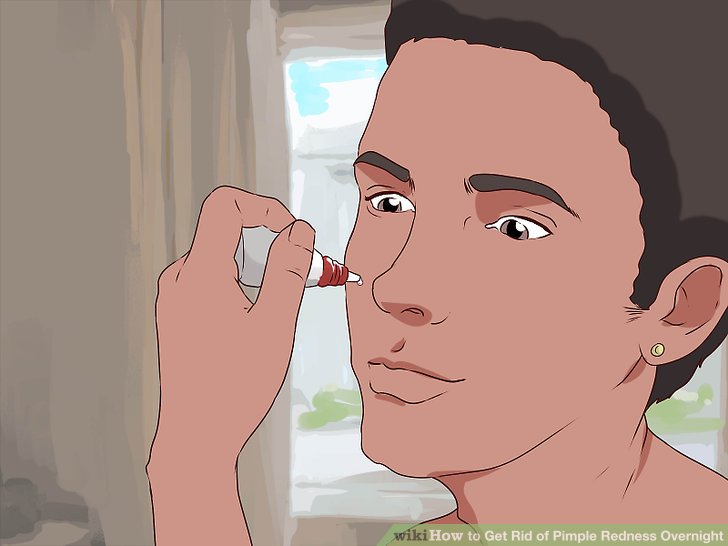 Bước 1: Bôi dung dịch thuốc nhỏ mắt lên nốt mụn
