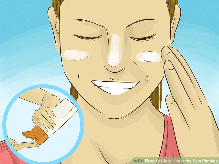 Bước 3: Tránh tiếp xúc trực tiếp với ánh nắng mặt trời để không gây kích ứng mụn trên da