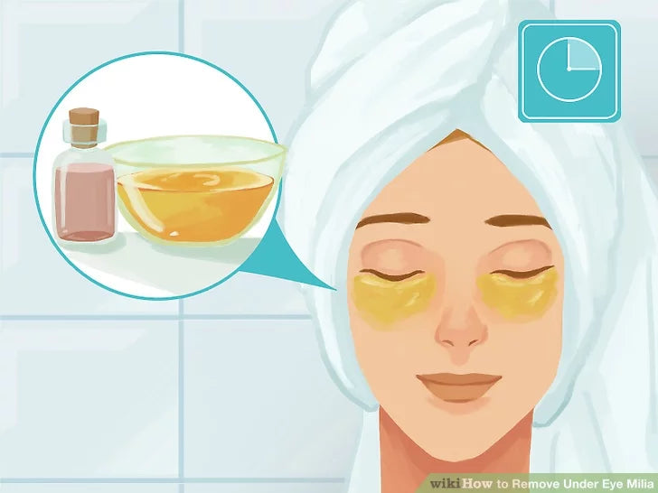 Bước 4: Sử dụng biện pháp khắc phục tự nhiên như mật ong hoặc nước hoa hồng, nếu muốn.