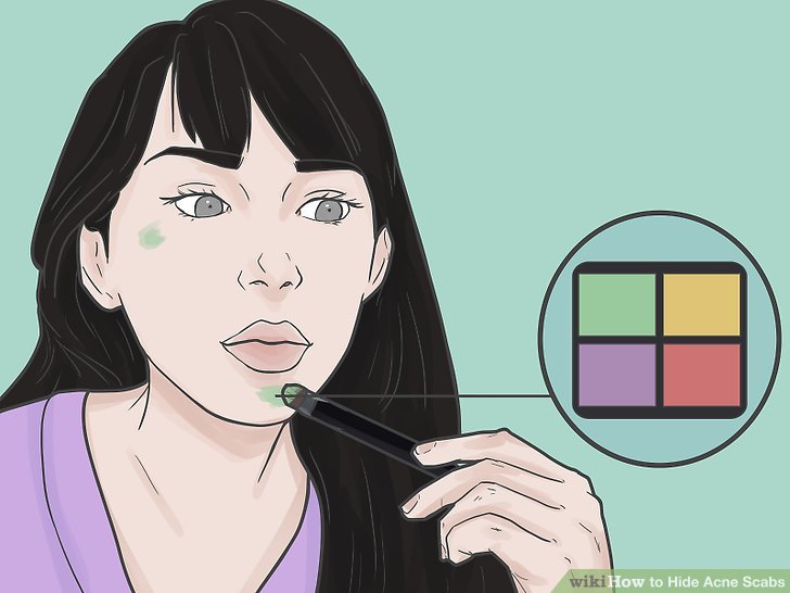 Bước 3: Chấm kem che khuyết điểm hiệu chỉnh màu sắc da lên các vết vảy mụn nếu có