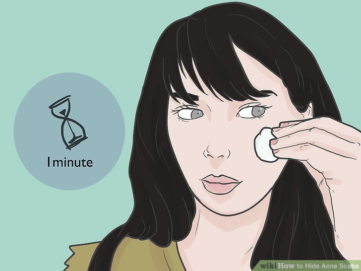 Bước 2: Chấm sữa rửa mặt lên các vết vảy mụn và để trong 1 phút để giảm tình trạng sưng mụn
