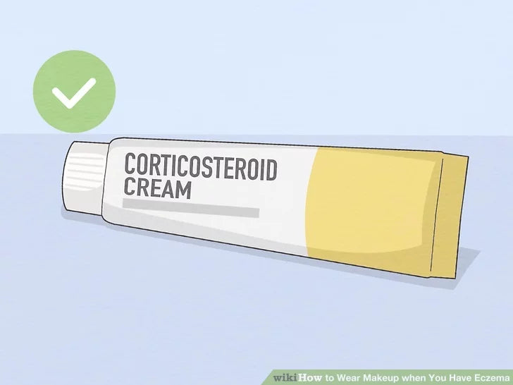 Bước 4: Hãy thử một loại kem thuốc để giảm viêm.