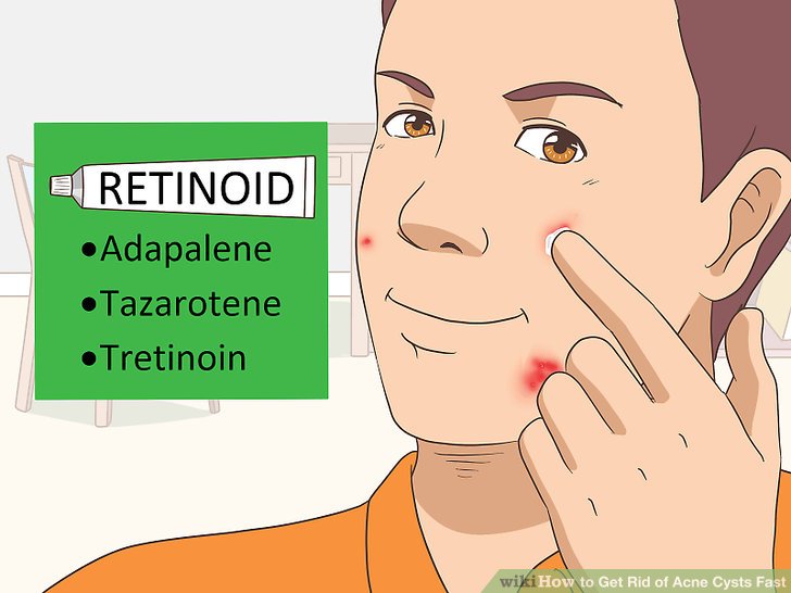 Bước 4: Bôi retinoid lên da