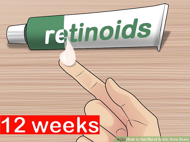 Bước 3: Sử dụng retinoids