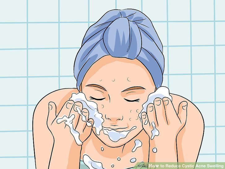 Bước 3: Làm sạch và điều trị mụn với các loại sữa rửa mặt và kem bôi có chứa thành phần thuốc điều trị mụn trứng cá không kê đơn
