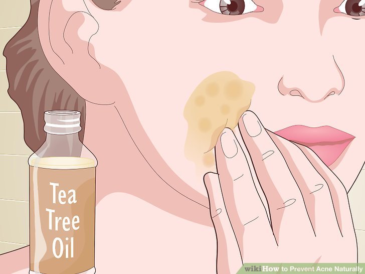 Bước 6: Chấm tinh dầu tràm trà lên mụn trứng cá để giúp mụn xẹp đi