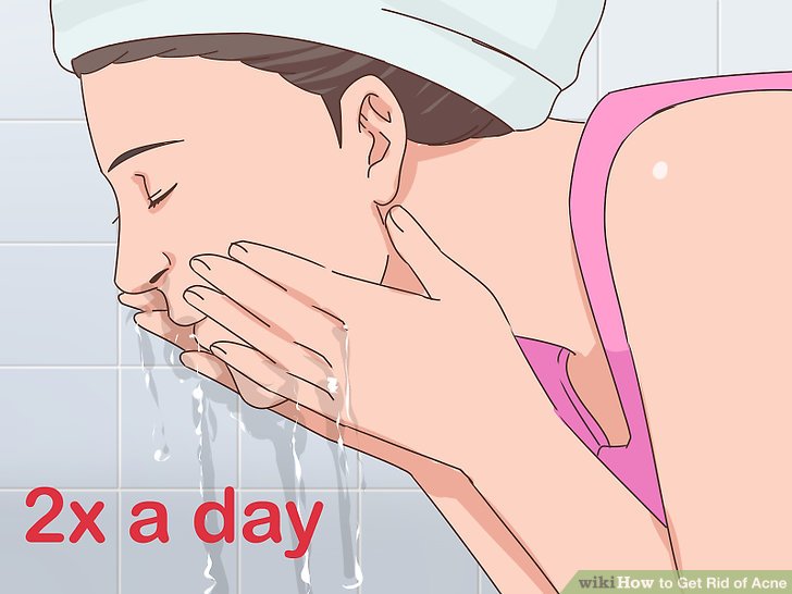 Bước 1: Rửa mặt hai lần mỗi ngày bằng sản phẩm rửa mặt có chứa Benzoyl peroxide