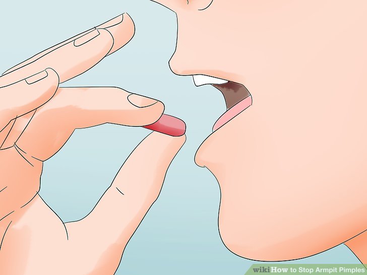 Bước 3: Uống thuốc giảm đau nếu bạn cảm thấy rất khó chịu