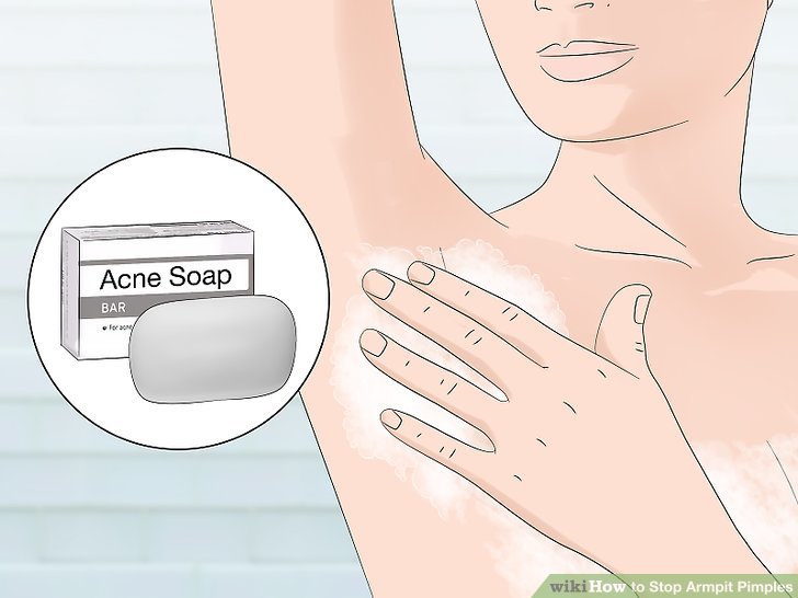 Bước 1: Rửa sạch vùng da nách bằng xà phòng trị mụn