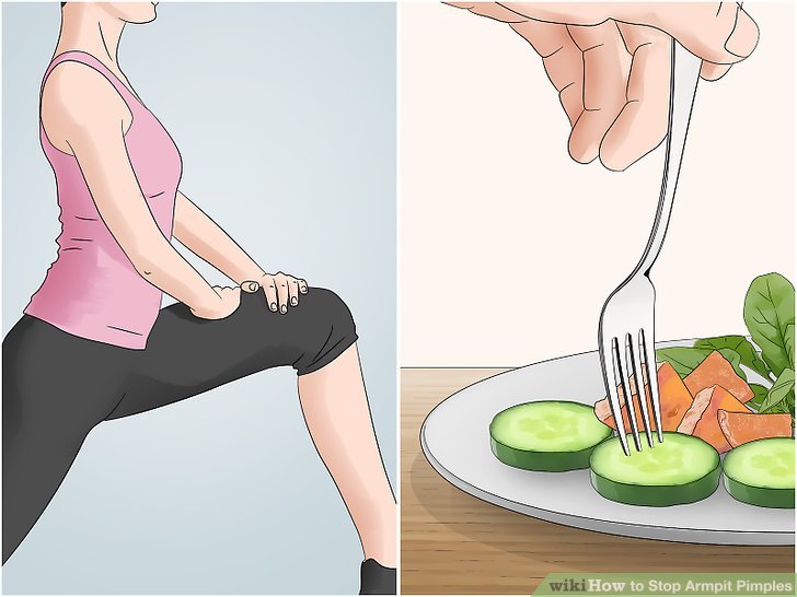 Bước 1: Giảm cân để ngăn ngừa mụn