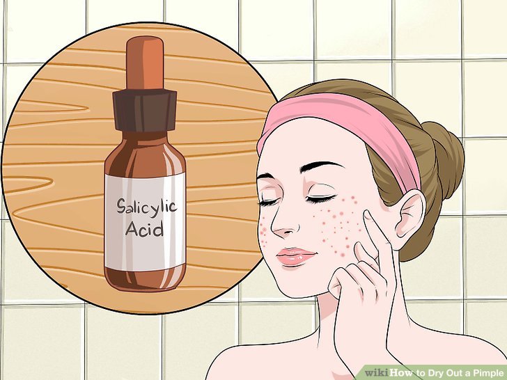 Bước 2: Sử dụng các sản phẩm chứa Axit salicylic