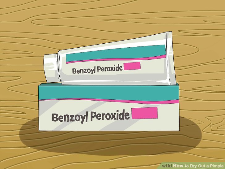 Bước 4: Hãy thử các sản phẩm có chứa Benzoyl peroxide