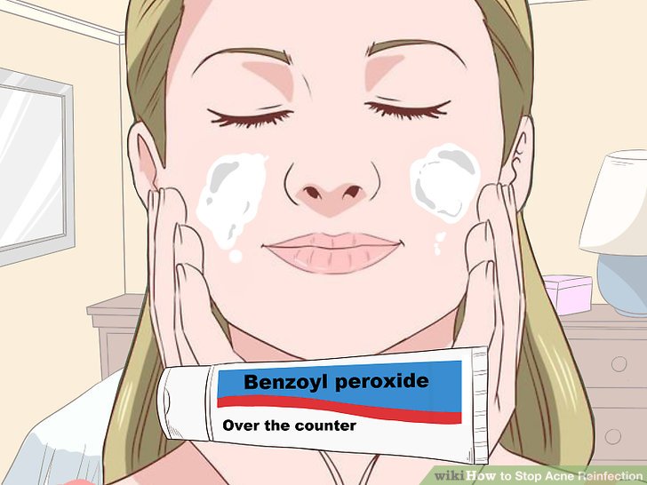 Bước 6: Dùng Benzoyl peroxide