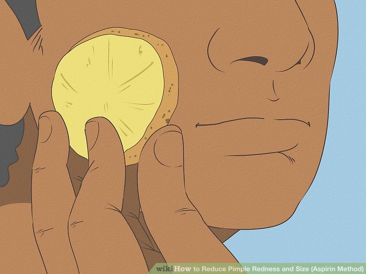 Bước 2: Đắp một lát khoai tây sống lên da