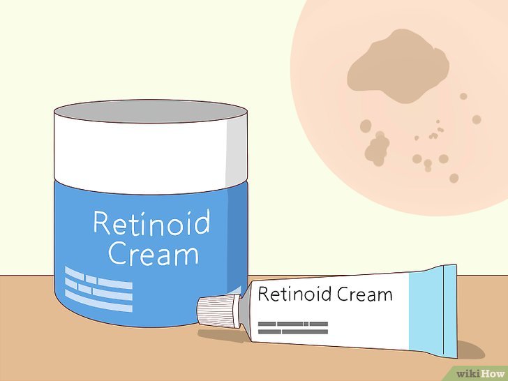 Bước 2: Một cách khác để giảm sắc tố da là sử dụng kem retinoid.