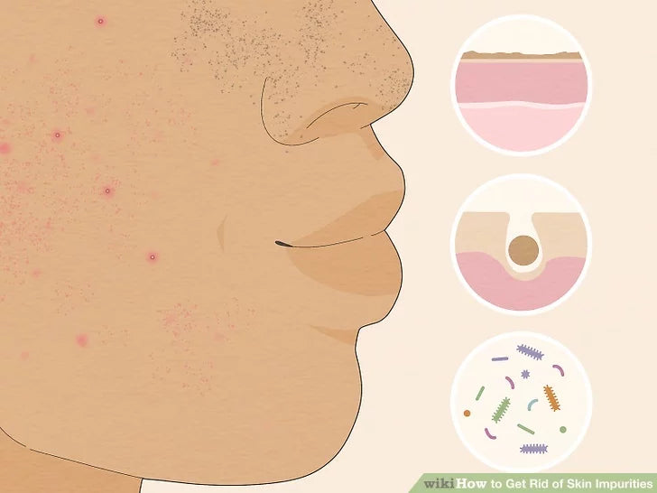 Bước 1: Xác định các tạp chất trong da của bạn.