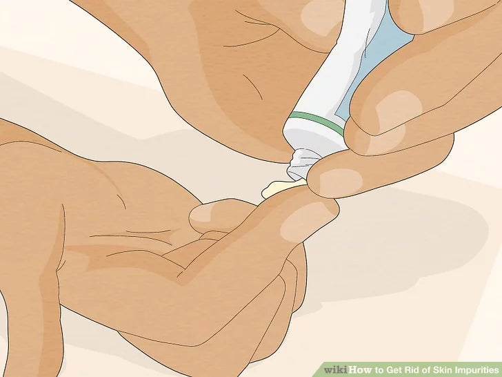 Bước 8: Bôi các loại kem bôi, kem dưỡng da hoặc gel.