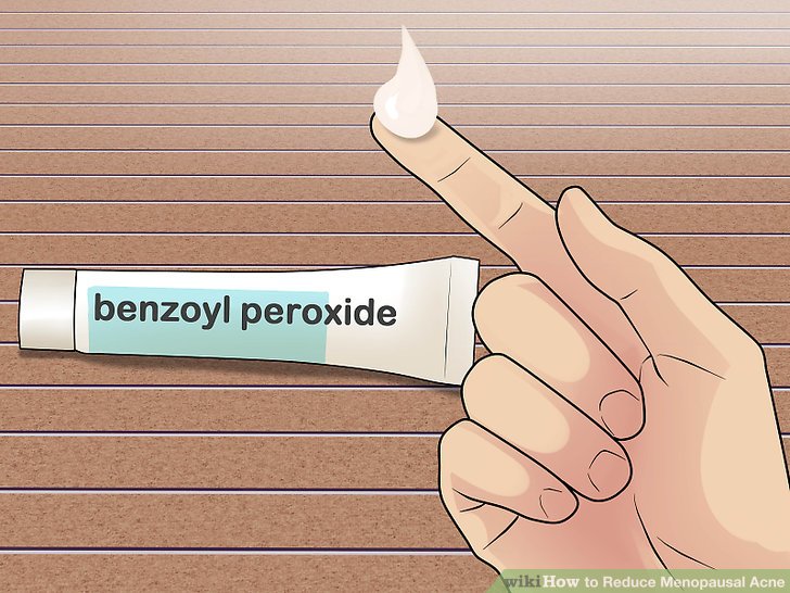 Bước 4: Trị mụn bằng benzoyl peroxide
