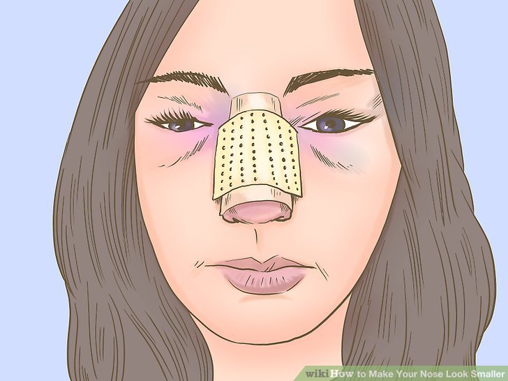 Bước 5: Lưu ý rằng bạn có thể phải đeo nẹp mũi trong tối đa một tuần.