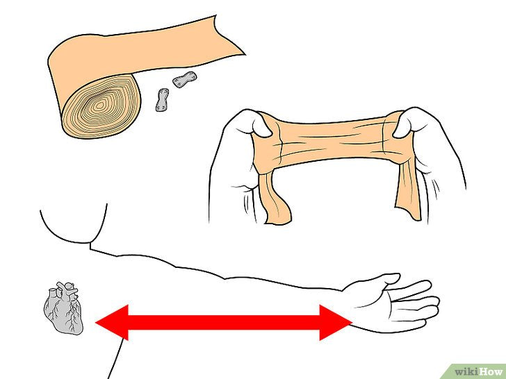 Bước 1: Quấn cổ tay là một biện pháp cấp cứu đơn giản nhưng hiệu quả khi bị chấn thương ở khớp.