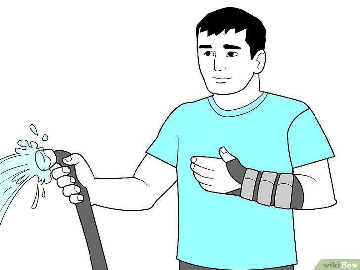 Bước 3: Để cổ tay hồi phục nhanh chóng, bạn cần giữ cho nó được thư giãn.