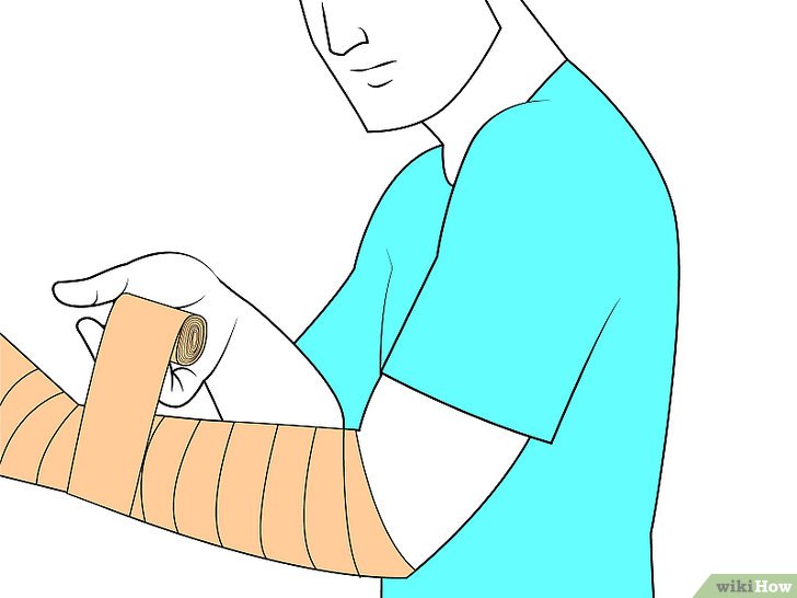 Bước 5: Băng bó cổ tay là một biện pháp hỗ trợ điều trị các chấn thương cổ tay như bong gân, trật khớp hay gãy xương.