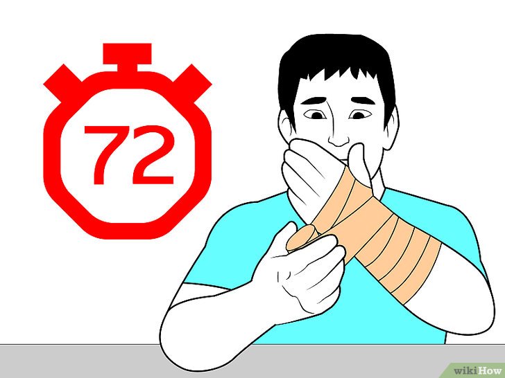 Bước 7: Băng cổ tay là một biện pháp hỗ trợ điều trị chấn thương cổ tay thường gặp.