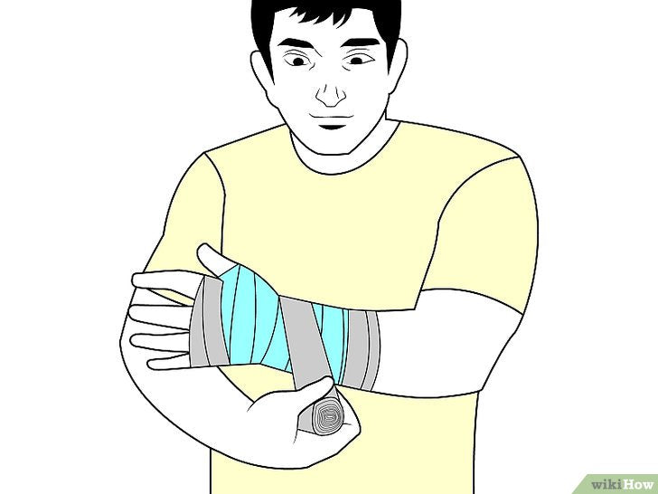 Bước 3: Bước cuối cùng trong việc băng bó cổ tay là neo băng đệm để chúng không bị tuột ra.
