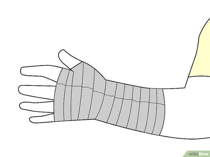 Bước 4: Để quấn cổ tay bằng băng keo, bạn cần chuẩn bị ít nhất hai cuộn băng keo y tế hay thể thao có bề rộng khoảng 4 cm.