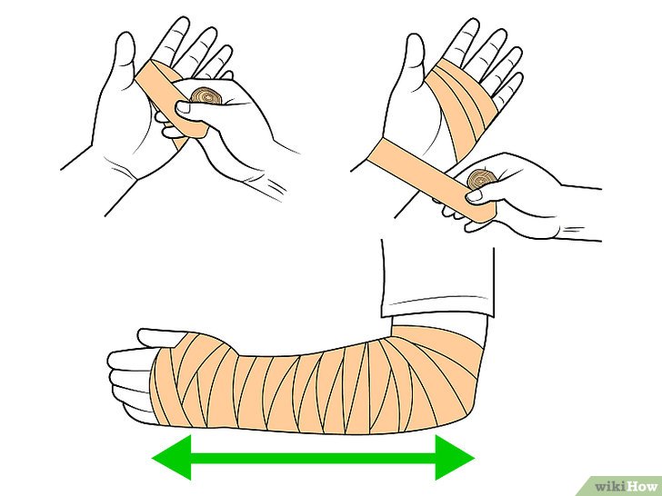 Bước 2: Băng quấn cổ tay là một phương pháp đơn giản và hiệu quả để hỗ trợ điều trị các chấn thương cổ tay thường gặp, như bong gân, trật khớp hay viêm khớp.