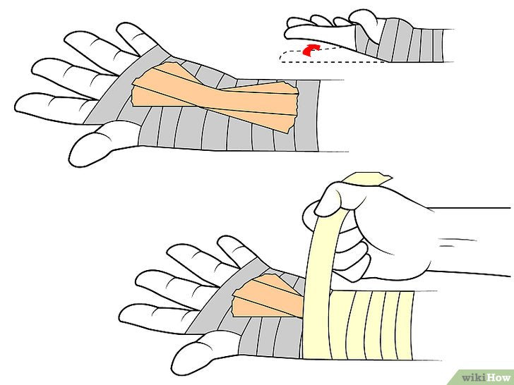 Bước 6: Để bảo vệ bàn tay khỏi chấn thương khi chơi thể thao, bạn có thể dùng miếng băng hình quạt để quấn bàn tay.