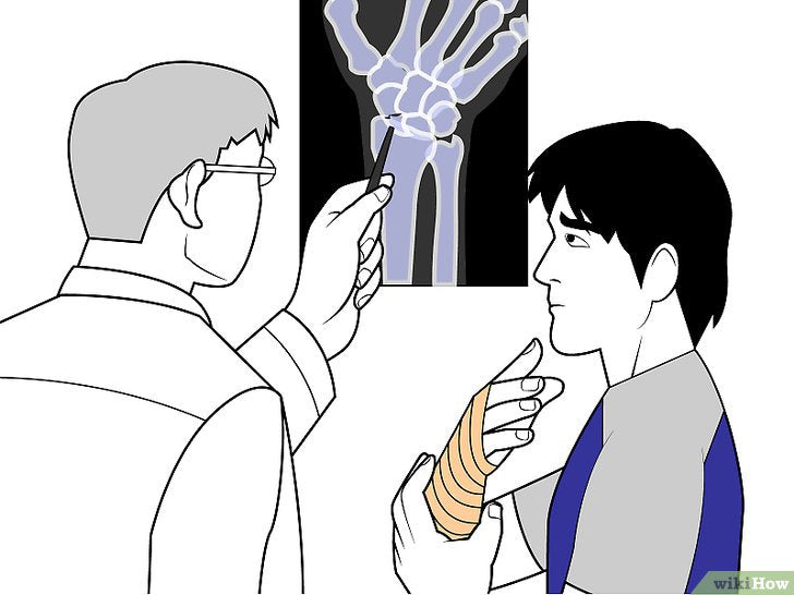 Bước 2: Việc chữa trị cổ tay gãy là rất quan trọng và không nên bỏ qua.