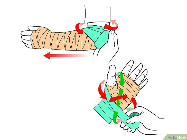 Bước 3: Để bảo vệ bàn tay và cổ tay khỏi chấn thương, bạn có thể sử dụng băng quấn để cố định các khớp và cơ.