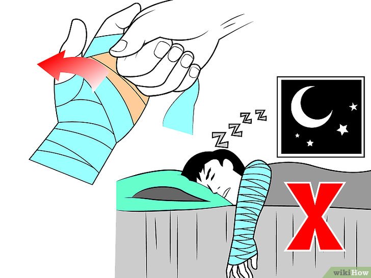 Bước 5: Tháo băng là một bước quan trọng trong việc chăm sóc vết thương cổ tay.