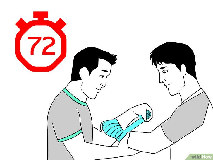 Bước 6: Tiếp tục băng cổ tay qua 72 giờ đầu tiên là một bước quan trọng trong việc chữa trị chấn thương cổ tay.