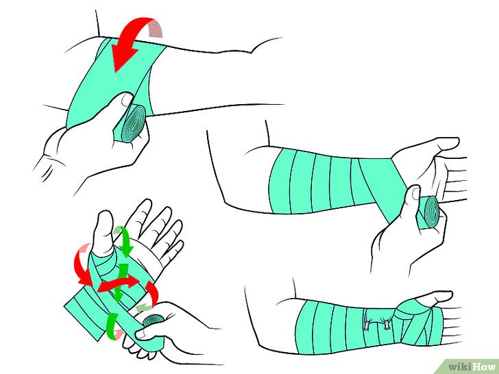 Bước 7: Một cách để bảo vệ cổ tay bị tổn thương là sử dụng một phương pháp quấn khác khi bạn muốn hoạt động lại.