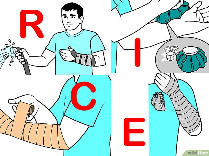 Bước 2: R-I-C-E là một phương pháp điều trị phổ biến cho các chấn thương cơ và gân.