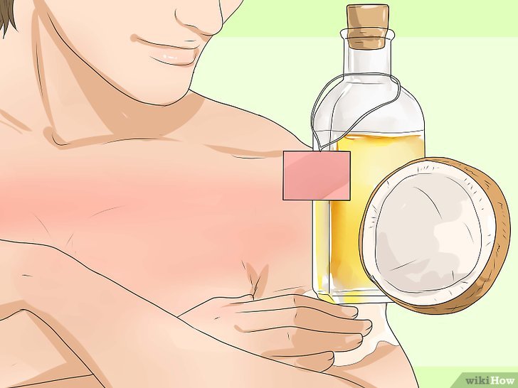 Bước 5: Bạn có biết cách chăm sóc da bị cháy nắng bằng dầu dừa không?
