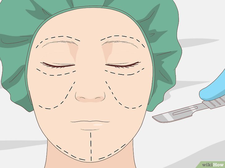 Cách 10: Phẫu thuật thẩm mỹ - Giải pháp cho bạn có gương mặt thon gọn và xinh đẹp.