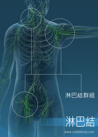 IHEALSMART 淋巴水腫