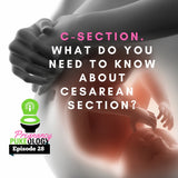 What do you need to know about a c-section