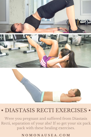 Diastasis Recti Workout