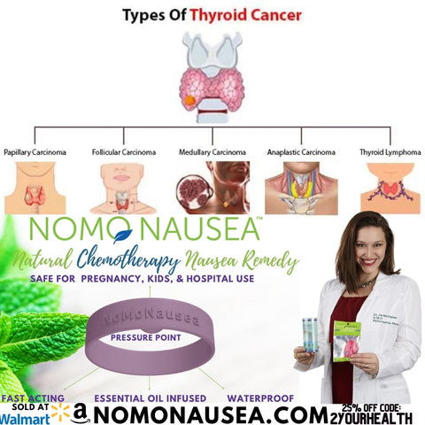 Types of thyroid cancer. And Dr. Darna explain best way to relieve chemotherapy in cancer nausea and vomiting with NoMo Nausea essential oil infused acupressure bracelet