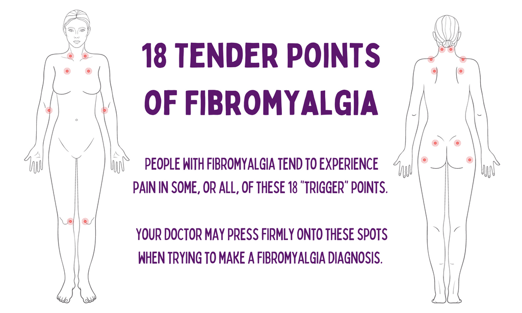 18 Tender Points of Fibromyalgia